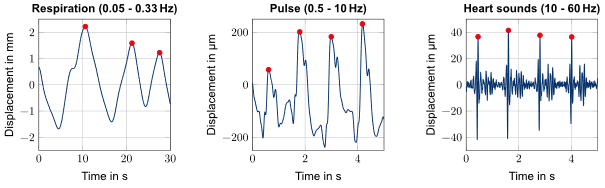 Radar-based Vital Sign Detection